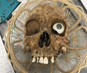 Human Skull With False Eye And Rotten Teeth Found In Charity Box
